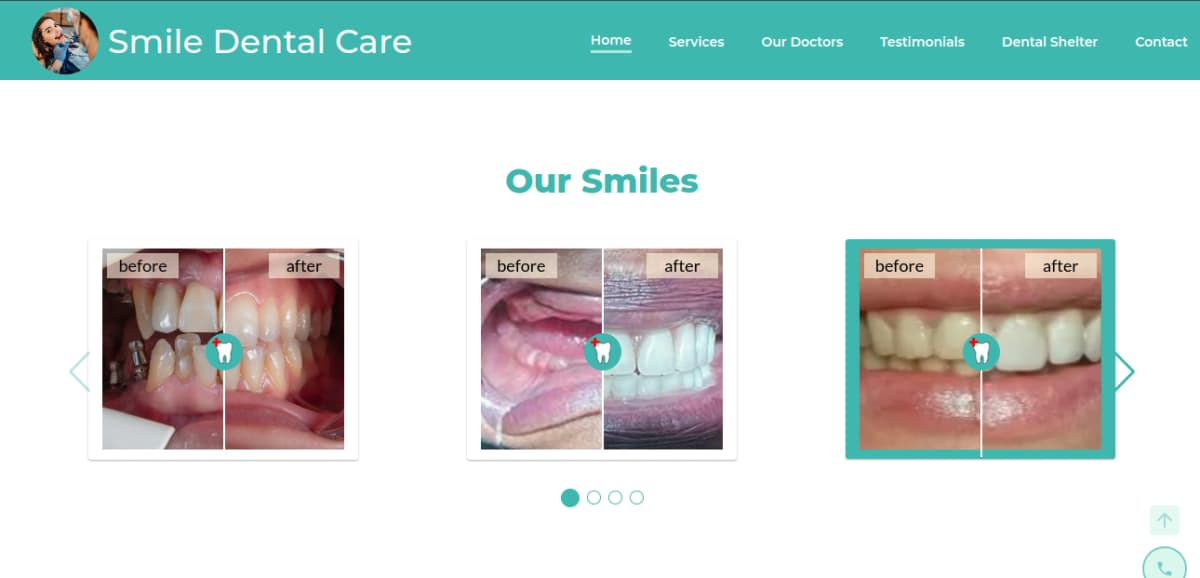 Before and After Gallery